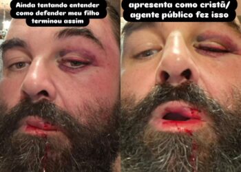 'Caí desacordado', diz homem que levou socos de guarda de folga ao reclamar de som alto em igreja de SC